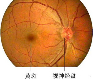 老年性黄褐斑