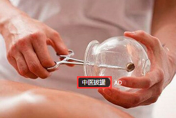 中医拔罐