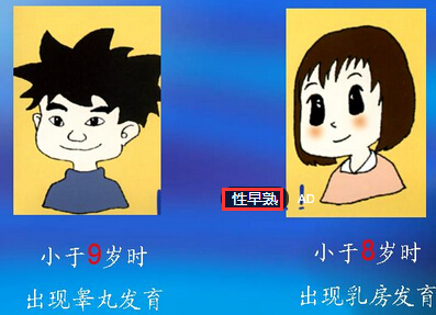 性早熟