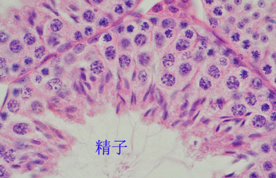 死精少精症