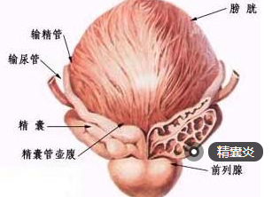 精囊炎