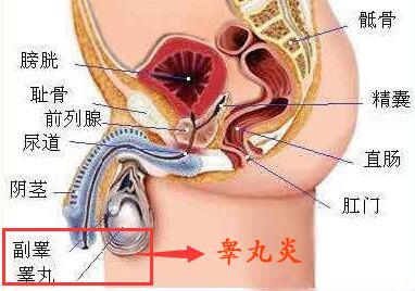 睾丸炎