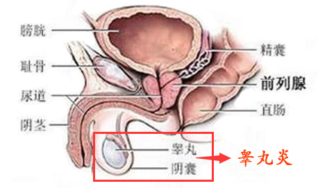 睾丸炎