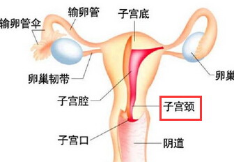 子宫内膜增生