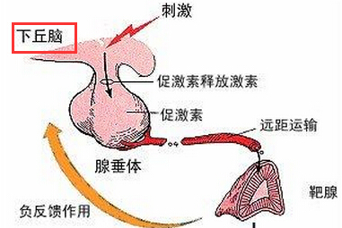 下丘脑综合征