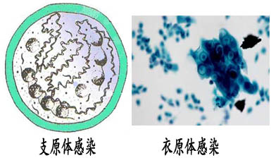 支原体衣原体阳性