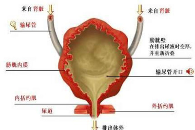 间质性膀胱炎