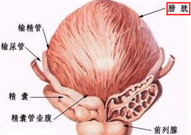 间质性膀胱炎