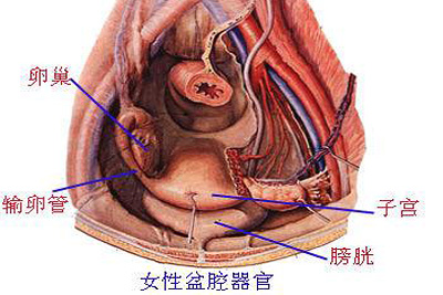 盆腔粘连