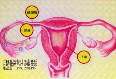 功能失调性子宫出血