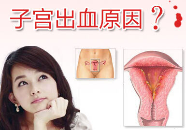 功能失调性子宫出血