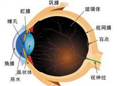 白内障