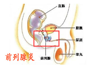 前列腺疾病