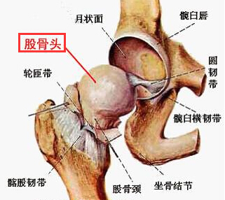 股骨头坏死