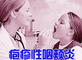 疱疹性咽峡炎