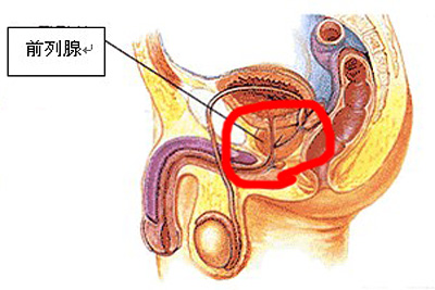 前列腺炎