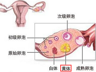 卵巢黄体破裂