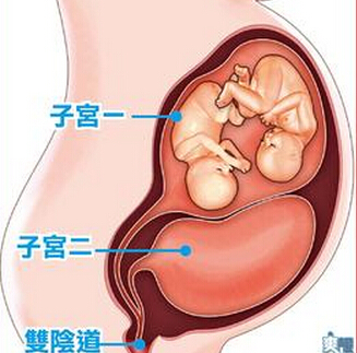 双子宫