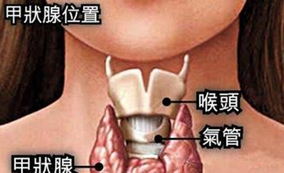 甲状腺结节