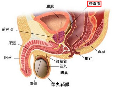 精囊腺肿大