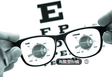 角膜塑形镜