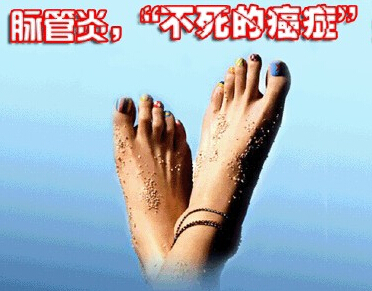 脉管炎