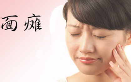 面瘫