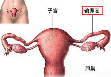 淋菌性输卵管炎