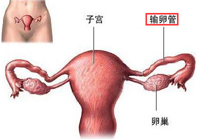 输卵管迂曲扭曲