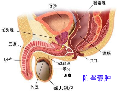 附睾囊肿头部囊肿