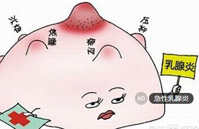 急性乳腺炎
