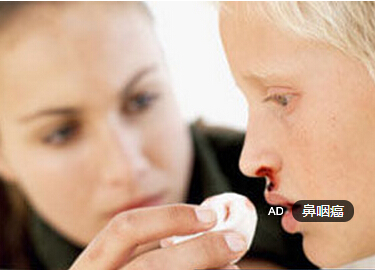 鼻咽癌