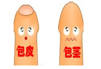 包皮包茎.png