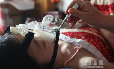 庞贝症患者
