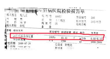 肾病综合症检验报告单