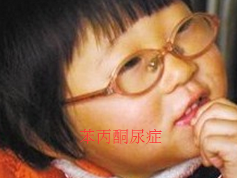 苯丙酮尿症.png