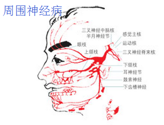 周围神经病.png