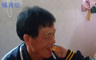 橘黄症.png