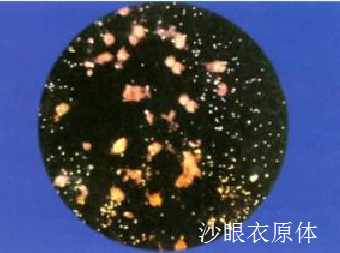 沙眼衣原体.png