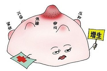 乳腺增生.png