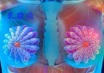 乳腺癌.jpg