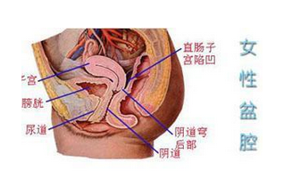 盆腔积液吃什么药好