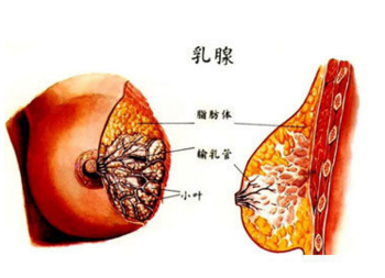 乳腺增生的症状