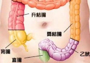 如何预防直肠癌