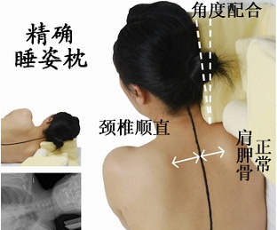 颈椎病的预防