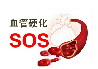 血管硬化吃什么食物好