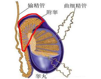 附睾囊肿的饮食疗法