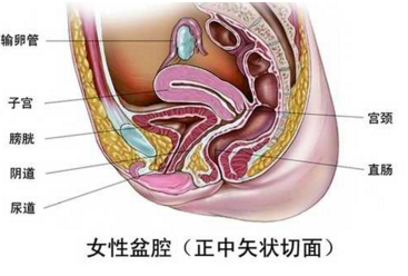 盆腔粘连的治疗