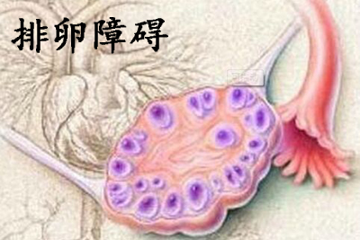排卵障碍如何检查