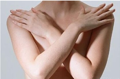 乳腺炎